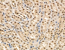 Invitrogen Phospho-eIF2 beta (Ser2) Polyclonal Antibody 100 &mu;L; Unconjugated:Antibodies,
