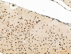 Invitrogen Phospho-eIF2 beta (Ser2) Polyclonal Antibody 100 &mu;L; Unconjugated:Antibodies,