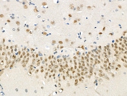 Invitrogen Phospho-eIF2 beta (Ser2) Polyclonal Antibody 100 &mu;L; Unconjugated:Antibodies,