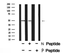 Invitrogen Phospho-GFAP (Ser13) Polyclonal Antibody 100 μL; Unconjugated:Antibodies,