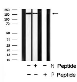 Invitrogen Phospho-GP130 (Tyr759) Polyclonal Antibody 100 μL; Unconjugated:Antibodies,