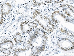 Invitrogen Phospho-INCENP (Thr59) Polyclonal Antibody 100 &mu;L; Unconjugated:Antibodies,