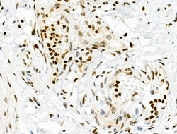 Invitrogen Phospho-INCENP (Thr59) Polyclonal Antibody 100 &mu;L; Unconjugated:Antibodies,