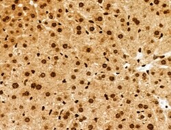 Invitrogen Phospho-INCENP (Thr59) Polyclonal Antibody 100 &mu;L; Unconjugated:Antibodies,