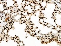 Invitrogen Phospho-INCENP (Thr59) Polyclonal Antibody 100 &mu;L; Unconjugated:Antibodies,