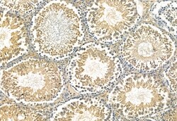 Phospho-IRF7 (Ser477) Polyclonal Antibody:Antibodies, Polyclonal