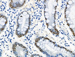 Invitrogen Phospho-MCM2 (Ser27) Polyclonal Antibody 100 &mu;L; Unconjugated:Antibodies,