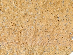 Invitrogen Phospho-Nudel (Thr219) Polyclonal Antibody 100 μL; Unconjugated:Antibodies,