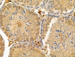 Invitrogen Phospho-Nudel (Thr219) Polyclonal Antibody 100 μL; Unconjugated:Antibodies,