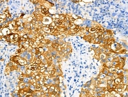 Invitrogen Phospho-NDRG1 (Ser330) Polyclonal Antibody 100 &mu;L; Unconjugated:Antibodies,