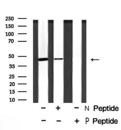 Invitrogen Phospho-NDRG1 (Ser330) Polyclonal Antibody 100 &mu;L; Unconjugated:Antibodies,