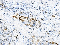 Phospho-NPM1 (Thr237) Polyclonal Antibody:Antibodies, Polyclonal