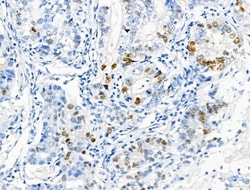 Phospho-NPM1 (Thr237) Polyclonal Antibody:Antibodies, Polyclonal