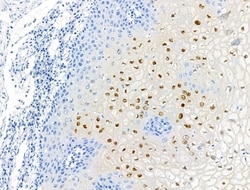 Phospho-NPM1 (Thr237) Polyclonal Antibody:Antibodies, Polyclonal