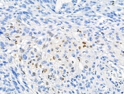 Phospho-NPM1 (Thr237) Polyclonal Antibody:Antibodies, Polyclonal