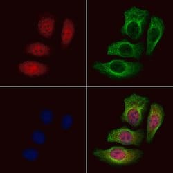 Phospho-NPM1 (Thr237) Polyclonal Antibody:Antibodies, Polyclonal
