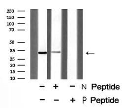 Phospho-NPM1 (Thr237) Polyclonal Antibody:Antibodies, Polyclonal