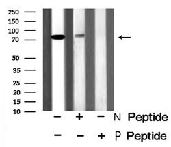 Invitrogen Phospho-p73 (Ser388) Polyclonal Antibody 100 μL; Unconjugated:Antibodies,
