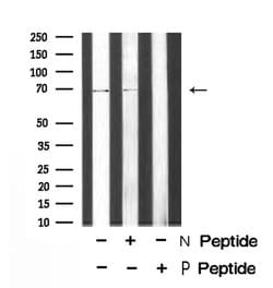 Invitrogen Phospho-Torc1 (Ser151) Polyclonal Antibody 100 &mu;L; Unconjugated:Antibodies,