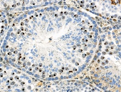 Invitrogen Phospho-Trf2 (Ser365) Polyclonal Antibody 100 μL; Unconjugated:Antibodies,