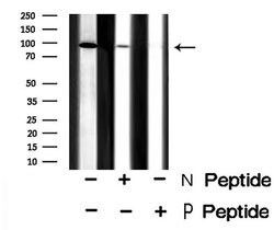Invitrogen Phospho-TRPV1 (Ser502) Polyclonal Antibody 100 μL; Unconjugated:Antibodies,