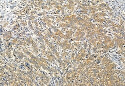 Invitrogen Phospho-TRPV1 (Ser502) Polyclonal Antibody 100 μL; Unconjugated:Antibodies,