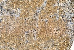 Invitrogen Phospho-TRPV1 (Ser502) Polyclonal Antibody 100 μL; Unconjugated:Antibodies,