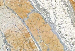 Invitrogen Phospho-TRPV1 (Ser502) Polyclonal Antibody 100 μL; Unconjugated:Antibodies,