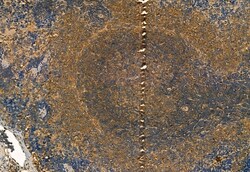 Invitrogen Phospho-TRPV1 (Ser502) Polyclonal Antibody 100 μL; Unconjugated:Antibodies,