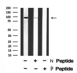 Invitrogen Phospho-Axl (Tyr698) Polyclonal Antibody 100 &mu;L; Unconjugated:Antibodies,