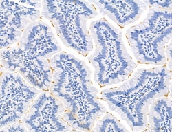 Invitrogen Phospho-Axl (Tyr702) Polyclonal Antibody 100 &mu;L; Unconjugated:Antibodies,