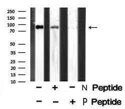 Invitrogen Phospho-Axl (Tyr702) Polyclonal Antibody 100 &mu;L; Unconjugated:Antibodies,
