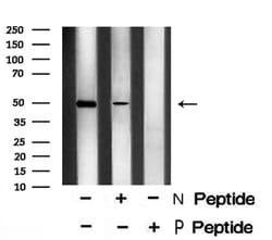 Invitrogen Phospho-YBX1 (Ser102) Polyclonal Antibody 100 &mu;L; Unconjugated:Antibodies,