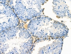 Invitrogen Phospho-Creatine Kinase BB (Ser199) Polyclonal Antibody 100