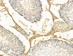 Invitrogen Phospho-Creatine Kinase BB (Ser199) Polyclonal Antibody 100