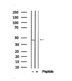 Invitrogen Phospho-Creatine Kinase BB (Ser199) Polyclonal Antibody 100