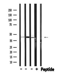 Invitrogen Phospho-HPD (Thr382) Polyclonal Antibody 100 &mu;L | Buy Online | Invitrogen&trade; | Fisher Scientific