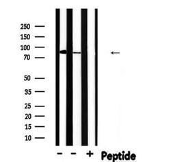Invitrogen Phospho-PFKP (Tyr52) Polyclonal Antibody 100 &mu;L; Unconjugated:Antibodies,