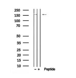 Invitrogen Phospho-DEPDC5 (Ser1002) Polyclonal Antibody 100 &mu;L | Buy Online | Invitrogen&trade; | Fisher Scientific