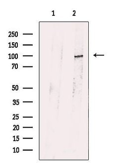Invitrogen PKD2 Polyclonal Antibody 100 &mu;L; Unconjugated:Antibodies,