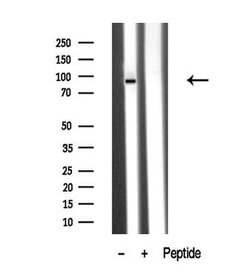 Invitrogen PKD2 Polyclonal Antibody 100 &mu;L; Unconjugated:Antibodies,