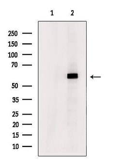 Invitrogen DYRK2/DYRK4 Polyclonal Antibody 100 &mu;L; Unconjugated:Antibodies,