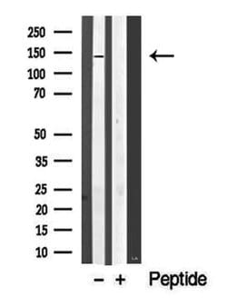 SIK1/SIK2/SIK3 Polyclonal Antibody:Antibodies, Polyclonal