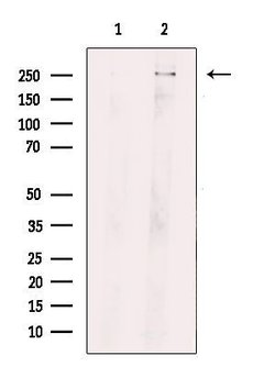 Invitrogen ROS1 Polyclonal Antibody 100 μL; Unconjugated:Antibodies,