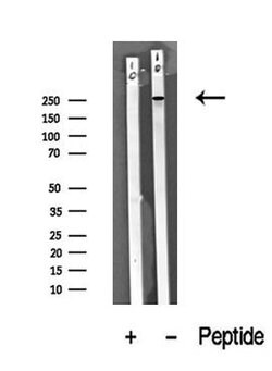 Invitrogen ROS1 Polyclonal Antibody 100 μL; Unconjugated:Antibodies,