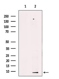 PDE6 gamma Polyclonal Antibody:Antibodies, Polyclonal