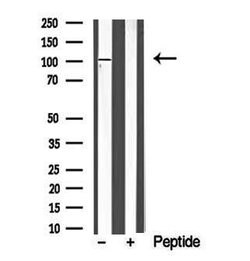 Invitrogen PRK1/PRK2 Polyclonal Antibody 100 &mu;L; Unconjugated:Antibodies,