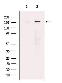 Invitrogen TOPBP1 Polyclonal Antibody 100 &mu;L; Unconjugated:Antibodies,