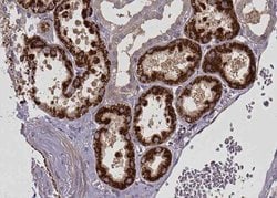 Invitrogen CPT1A Polyclonal Antibody 100 &mu;L; Unconjugated:Antibodies,