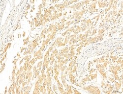 Invitrogen CPT1A Polyclonal Antibody 100 &mu;L; Unconjugated:Antibodies,